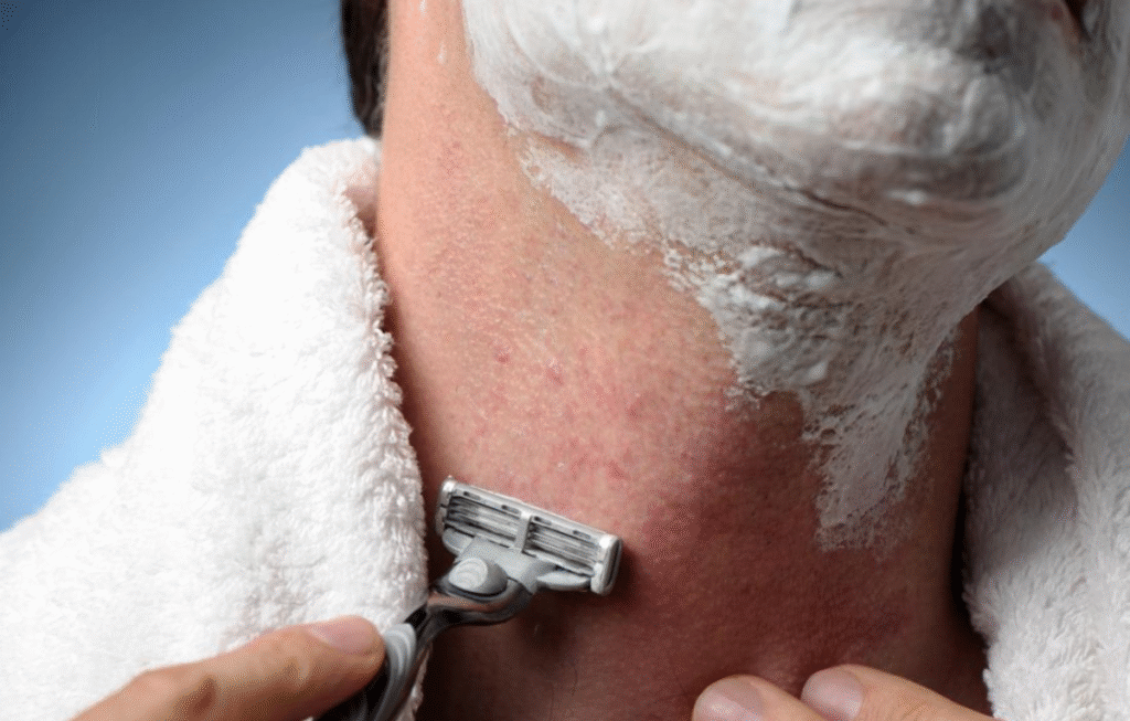 Razor Burn Solutions: How to Avoid Irritation While Shaving