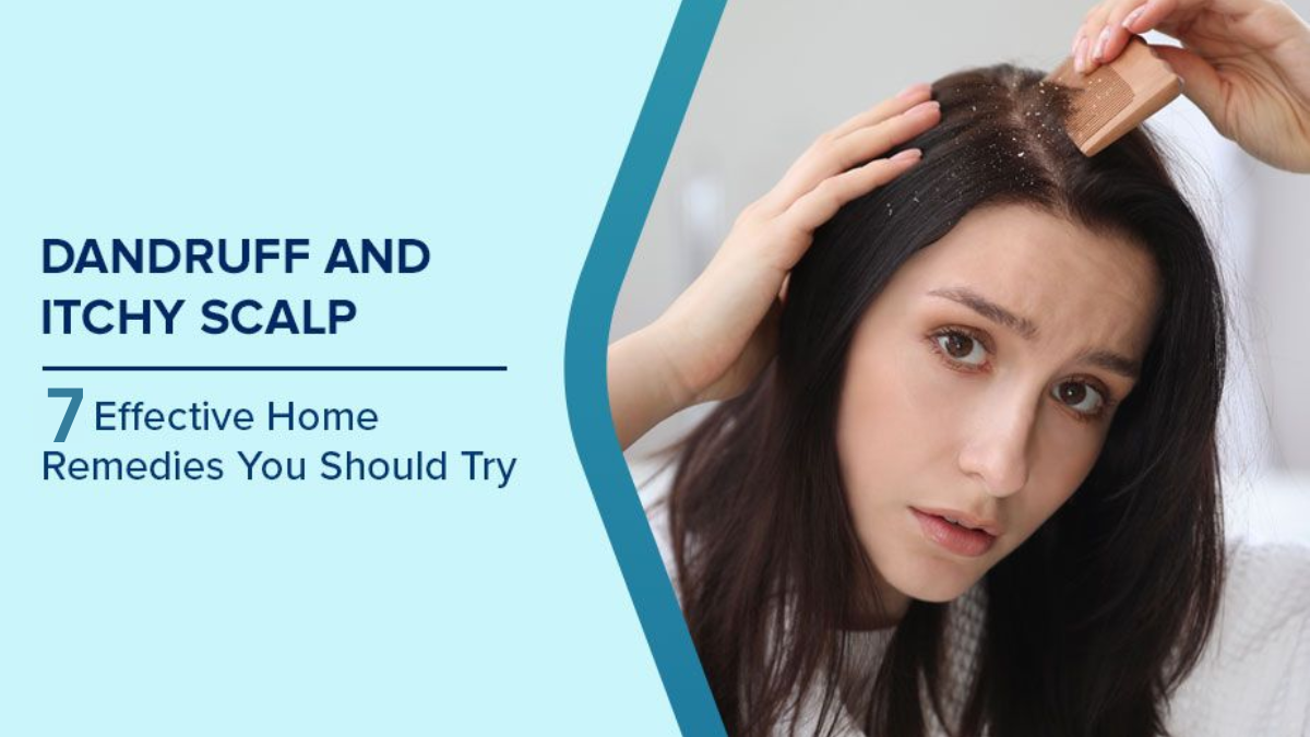 Best Home Remedies for Dandruff That Actually Work Fast